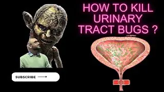 Uncomplicated Urinary Tract Infection (Simple UTI)