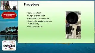 KSOS 2025  IC25  T Dr Leema Rose Thomas  &ldquo;Unlocking the angle&rdquo;  Gonioscopy techniques for clinicians