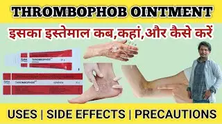 Thrombophob Cream Kis Kaam Aati Hai | Thrombophob Cream Price | Thrombophob Cream Kaise Use Kare 
