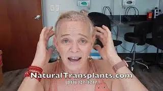 Bethesda, Maryland Natural Hair Transplant | Get a Great Hair Transplant in Bethesda.