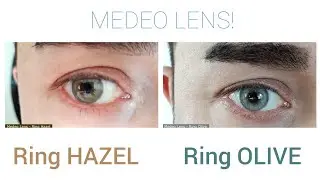 MEDEO LENS! RİNG HAZEL VE RİNG OLİVE! DOĞAL &Ouml;TESİ BİR ELA YEŞİLİ VE GRİ LENS!