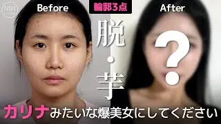 【美女は作れる】芋顔からカリナ顔への垢抜け方がヤバすぎる...輪郭3点で本気の大変身💖