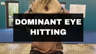 RAPHAEL TURNER | DOMINANT EYE HITTING