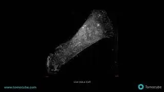 Live cell imaging using Holotomography