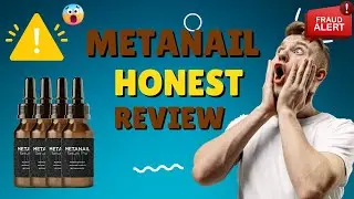 Metanail Complex Review: ( 🛑⚠️BIG WARNING!! ⚠️🛑) | Metanail Complex Supplement| Metanail Srum Pro