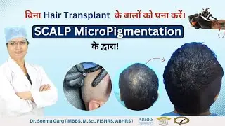 स्कैल्प माइक्रो पिगमेंटेशन क्या है? | What is SMP (Scalp MicroPigmentation) for Hair Loss Treatment