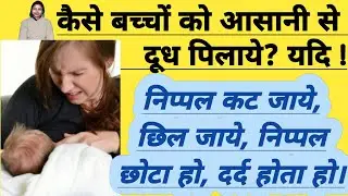 बच्चों को दूध पिलाते समय निप्पल कट, छील जाये, निप्पल छोटा हो तो कैसे बच्चे को आसानी से दूध पिलाये।
