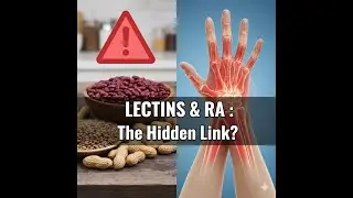 Do Lectins Cause Rheumatoid Arthritis? Let's Examine the Evidence