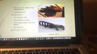History of Prosthetics