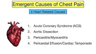 Causes of Chest Pain  EASY TRICK to Never Miss an Emergency Must See