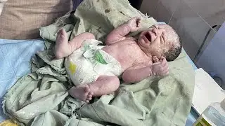 Urgent Baby Rushed to NICU 🚨 | Unexpected Danger Signs | Emergency Newborn Assessment