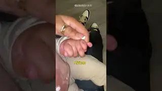Ethnic differences in polydactyly?