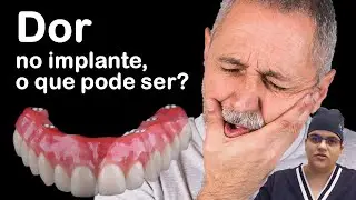 Voc&ecirc; sentindo dor no seu implante? Assista esse v&iacute;deo!| Dra Bianca Rosa | Cl&iacute;nica Bianca Rosa