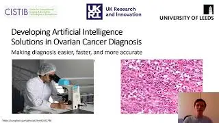 Jack Breen PhD Introduction Video