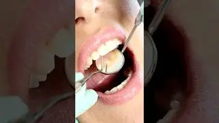 🔎🦷Dentist&rsquo;s Mirror😲✨What&rsquo;s Inside Your Mouth?