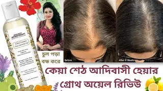 Keya Seth Tribal Essence Hair Growth Oil Review || Alopex Penta || Real Souvik Mondal || Keya Seth |