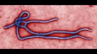 Sophia Jackson Final Immunology Project-Immune Response to Ebola