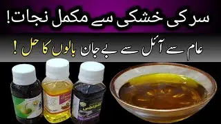 Say Goodbye to Dandruff Forever with This Powerful Natural Hair Treatment | By The Rozeena Kitchen