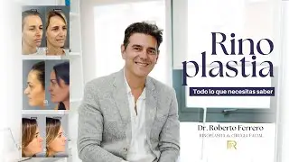RINOPLASTIA: Beneficios, candidatos y recuperaci&oacute;n | Todo lo que debes saber antes de operarte.