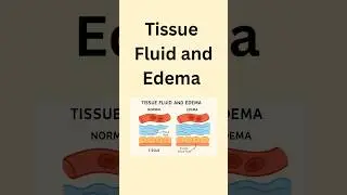Tissue Fluid and Edema