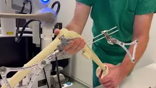 EOC certificato Velys Knee Robotics