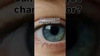 Reasons your eye color might change.