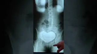 Gonstead Analysis Xray review