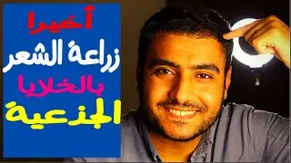 زراعة الشعر بالخلايا الجذعية الحلم المنتظر