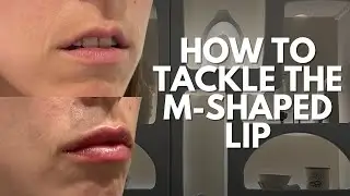 THE M-SHAPED LIP