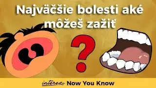 Toto sú tie NAJVÄČŠIE BOLESTI aké môžete zažiť