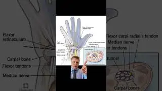 Can you see carpal tunnel syndrome on X-ray? #carpaltunnelsyndrome #carpaltunnel #xray #chiropractic