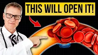 Лучшее блюдо для очищения артерий (доказано наукой)
