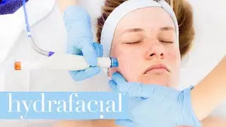 How does HydraFacial treatment work?