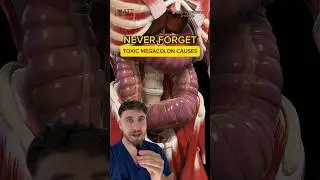 Remember MORE toxic megacolon causes!