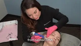 VAMP Facial with Kristi | PDRN Therapy El Paso Plastic Surgery
