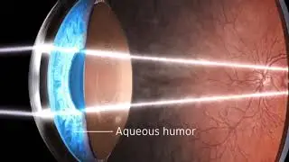 Anatomy of Vision