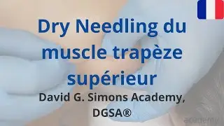 Dry Needling du muscle trap&egrave;ze sup&eacute;rieur