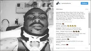 Who Shot Shredgang Boogz in the FACE !? Beef With Rocaine/Kalamazoo