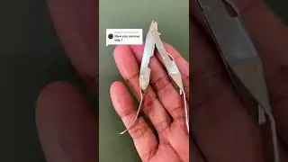 How to remove a skin stapler? #surgery #skills #skincare