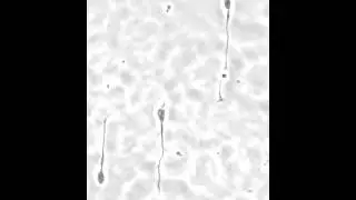 Axon growth cone of primary rat hippocampal neurons on Motility CYTOOchips