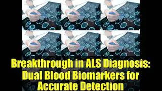 Breakthrough in ALS Diagnosis: Dual Blood Biomarkers for Accurate Detection