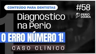 #58 - Diagnóstico na Perio - o  ERRO número 1! Caso clínico