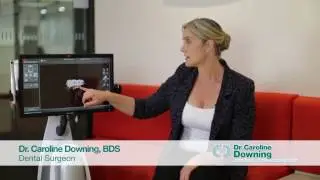 Benefits Of An Intra-Oral Scanner For Dental Patients - Dr. Caroline Downing | NSW Cosmetic Dentist