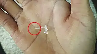 Earring Allergies Solved: A Guide to Skin Friendly, Easy, Quick and Cheap to Fix