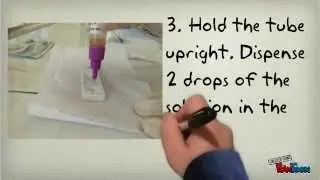 Fecal Occult Blood test