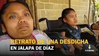 Retrato de una desdicha en Jalapa de Díaz, Oaxaca; tres hermanos, sentenciados a una enfermedad