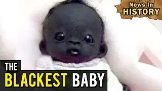 The Blackest Baby In The World - News In History