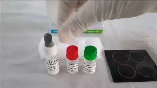 ASO TEST