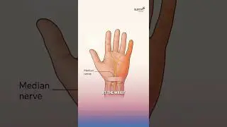 Surya Hospitals | Carpal Tunnel Syndrome | Pregnant Women | Hand and Wrist Surgeon