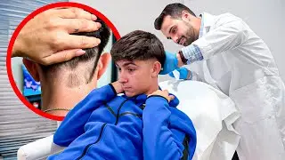 ME ESTOY QUEDANDO CALVO